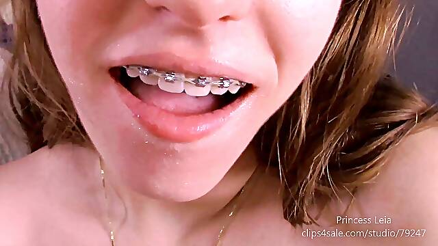 Blow it on my braces